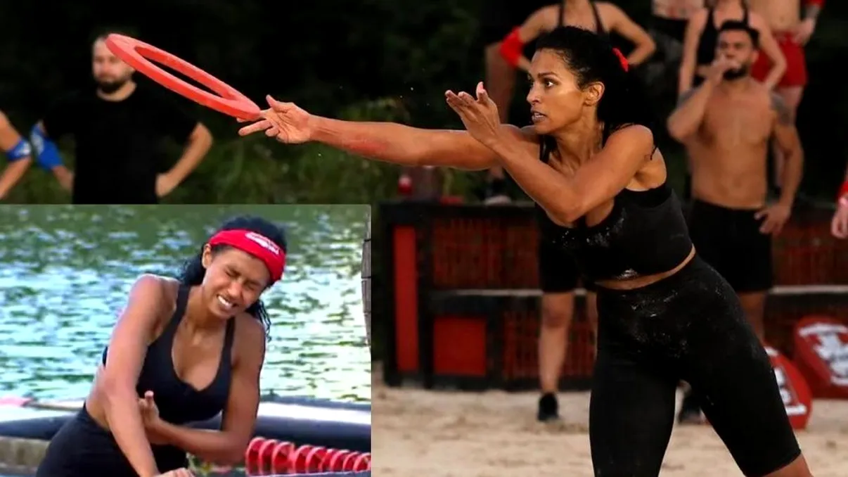 Ce sechele are Majda după Survivor România 2021. Va rămâne cu ele, pe viață