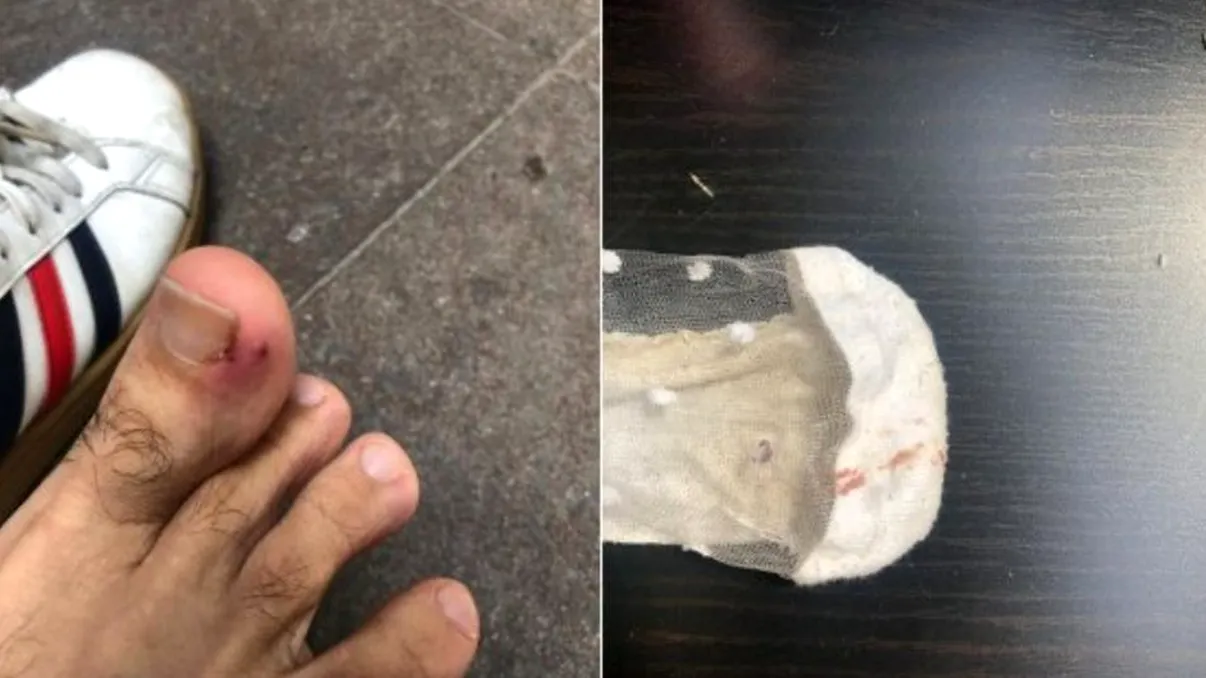 Tânăr de 26 de ani, mușcat de un șobolan în centrul Capitalei. Ce povestește că i s-a întâmplat. Halucinant