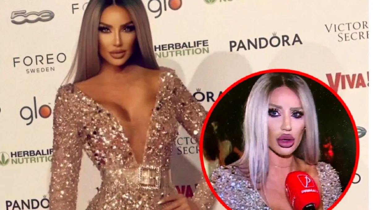 Bianca Drăgușanu, apariție șocantă cu ochiul vânăt. Din nou! Ce susține că a pățit de data aceasta