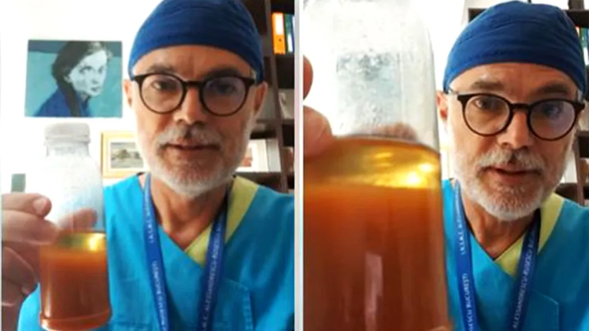 Dr. Mihai Craiu, semnal de alarmă după descoperirea unui suc 