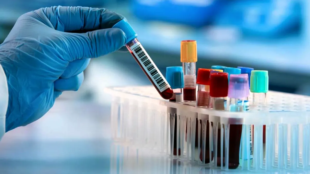 Analize şi tratamente gratuite pentru aceşti români. E o premieră, nu s-a mai întâmplat asta la noi în ţară