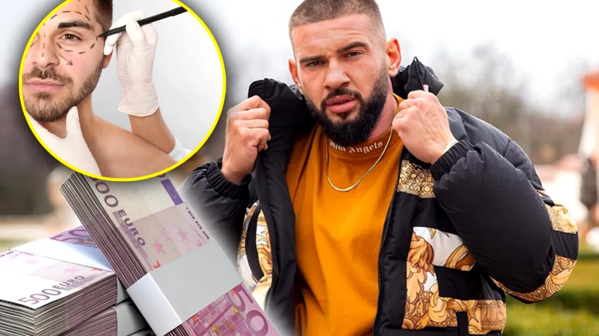 La ce intervenție estetică a apelat Dorian Popa, „Prinţul Internetului”. „Zici că lucrează cu bibelouri”. Afacerea care l-a îmbogățit într-o zi cu 200.000 de euro EXCLUSIV