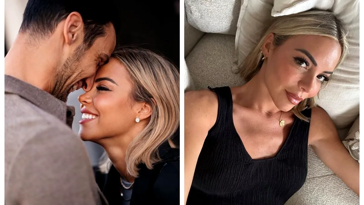 Cum arată portarul lui PSG, după ce a fost lovit cu copita în cap de un cal. Sergio Rico a stat 22 de zile în comă - FOTO