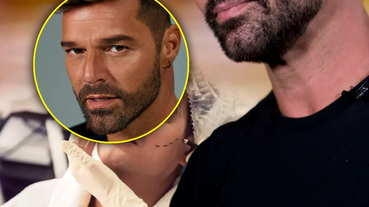 Un bărbat a făcut 40 de operații estetice pentru a fi sosia lui Ricky Martin. Cum arată acum FOTO