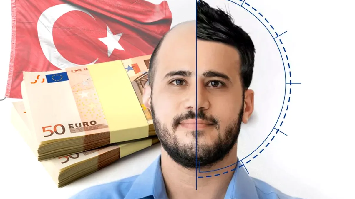 Cât costă un implant de păr în Turcia în 2024. Ce trebuie să știi înainte de a îți face procedura