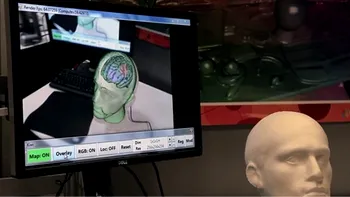 Kinect Fusion demonstreaza aplicatii in chirurgie prin AR
