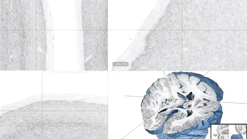 Big Brain: O harta detaliata a creierului uman este disponibila online [VIDEO]
