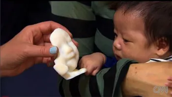 Copiii, in imprimare 3D... inca din burta [VIDEO]