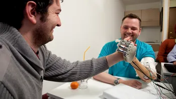 O mână bionică poate oferi din nou simțul tactil