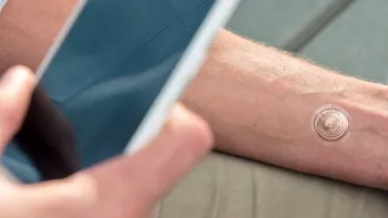Două idei pentru securitatea telefonului: tatuajul Motorola și aura electronică