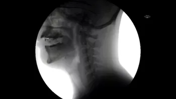 Razele X ne arată ce se întâmplă în corpul nostru atunci când mâncăm și bem [VIDEO]