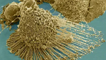 ”Înfometarea” cancerului pare cea mai sigură metodă de a-l combate