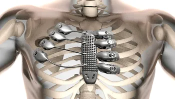 O româncă a descoperit un metal de patru ori mai rezistent decât titanul