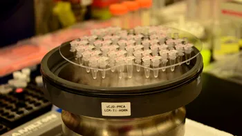 Un nou test de sânge ar putea detecta proteinele infecțioase