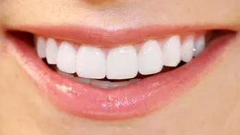 Un medicament pentru Alzheimer te poate scăpa de vizitele la dentist