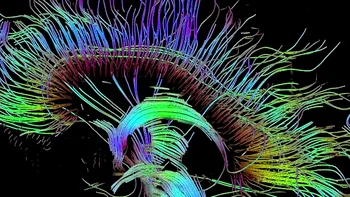 Persoanele creative au mai multe conexiuni neuronale
