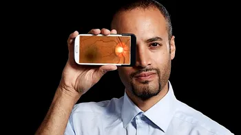 Utilizarea intensă a smartphone-ului ți-ar putea schimba forma ochilor