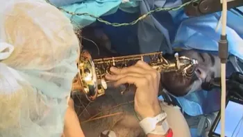 Un tânăr a cântat la saxofon în timp ce era operat pe creier [VIDEO]