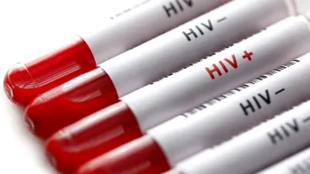 De ce nu avem un vaccin pentru HIV, la 40 de ani de la descoperirea virusului