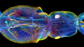 Cele mai spectaculoase fotografii la microscop ale anului 2017