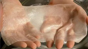 Medicii au reconstruit piele cu celule modificate genetic
