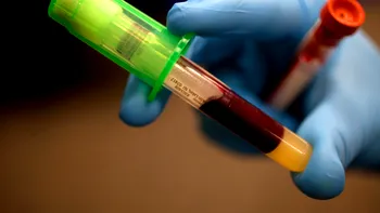 Un nou test de sânge ar putea detecta opt tipuri de cancer