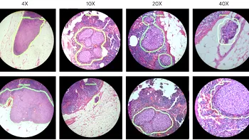 Google vrea să rezolve problema cancerului cu acest microscop inteligent