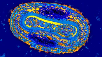 Un adolescent s-a infectat cu un virus care făcea ravagii în secolul 18
