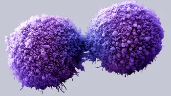 Imagini spectaculoase cu celule canceroase observate la microscop