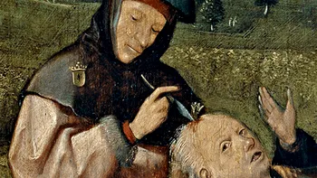 Practicile medicale din antichitate care ucideau oameni mai rapid ca bolile