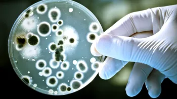 Bacteria care te face rezistent la stres