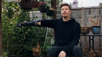 Omul care și-a pus o mână bionică după ce a fost inspirat de un joc video