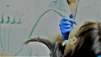 Noua descoperire care te va scăpa permanent de plombele dentare