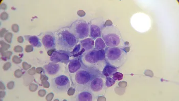 Toate tipurile de cancer ar putea avea o singură cauză (și acum putem spera la o soluție)