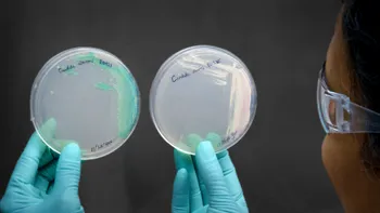 Infecția misterioasă letală care face înconjurul lumii și pare de neoprit
