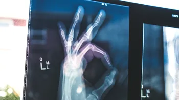 Premieră în medicina românească: „robotul” care analizează radiografiile