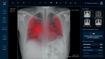 „Robotul” care analizează radiografiile pacienților din București și Timișoara ca să „vadă” dacă sunt bolnavi