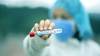 Acest test cu nanodiamante poate detecta timpuriu coronavirusul