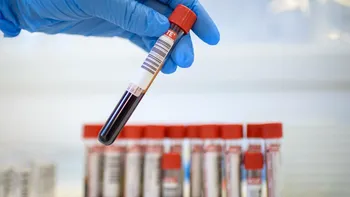 Analize și consultații gratuite în România: ce beneficii ai cu asigurarea de sănătate de la stat
