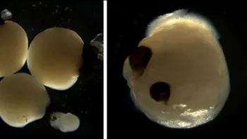 Experimentul desprins din Frankenstein: mini creiere cu ochi, care vor ajuta la transplanturi