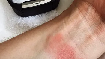 Dacă ai un Fitbit, trebuie să știi asta: te poate arde la mână, trebuie trimis înapoi