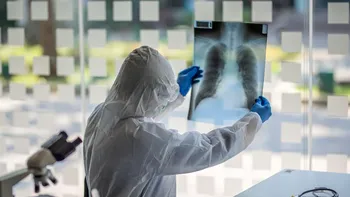 Un bărbat s-a vindecat de Covid după 411 zile de infectare. „Încă lucrăm pentru a înțelege cel mai bun mod de a-i proteja”