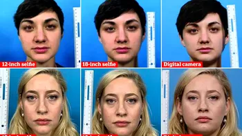 Ai nasul mare? S-ar putea să-ți faci prea multe selfie-uri: cum te minte camera foto a telefonului tău