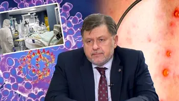 Alexandru Rafila, anunț despre variola maimuței. Ce măsuri de protecție recomandă ministrul Sănătății