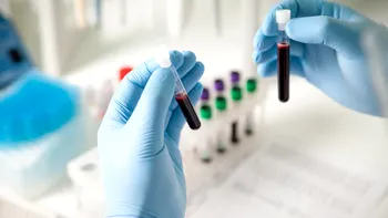 Cele mai mari amenințări din Europa: Pandemiile, amenințările chimice, biologice și nucleare