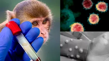 Prima persoană vaccinată împotriva variolei maimuței în România, cine este. Anunțul făcut de Ministerul Sănătății