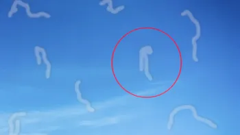 Micile dungi albe ce apar ”în fața ochilor”, pe retină. Ce sunt acestea și de ce se formează?