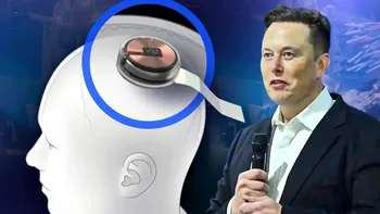 Implantul pe creier pe care ți-l pregătește Elon Musk ar putea veni la pachet cu schimbări: ce se întâmplă cu cipul Neuralink