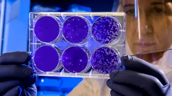 Computerul alimentat de celulele creierului uman devine realitate. Ce este inteligența organoidă și cum depășește inteligența artificială