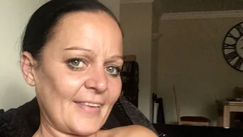 A vrut să își pună fațete dentare în Turcia, dar a rămas mutilată pe viață: „Am găuri în gingii unde putrezește mâncarea”